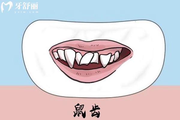 老鼠牙可以做牙齒矯正嗎