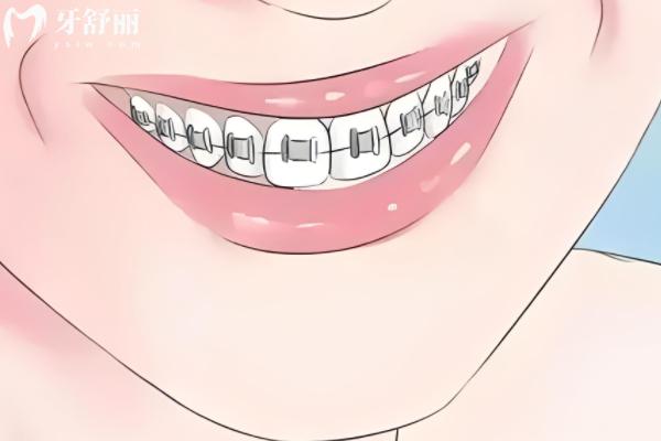 長(zhǎng)春做矯正牙齒正規(guī)的口腔醫(yī)院