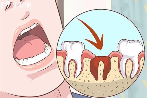 惠州看牙收費標準