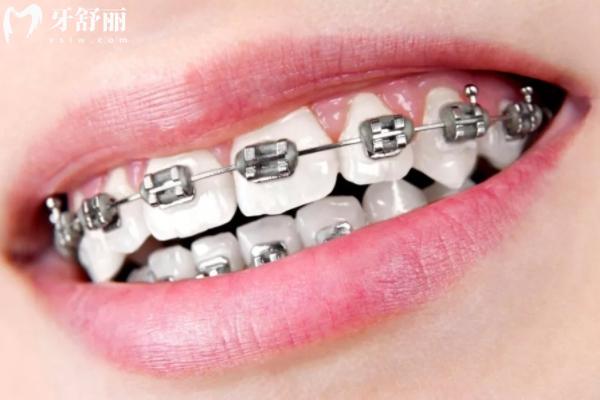 福州正畸醫(yī)院排名前十名單