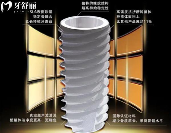 韓國(guó)八維種植體質(zhì)量怎么樣