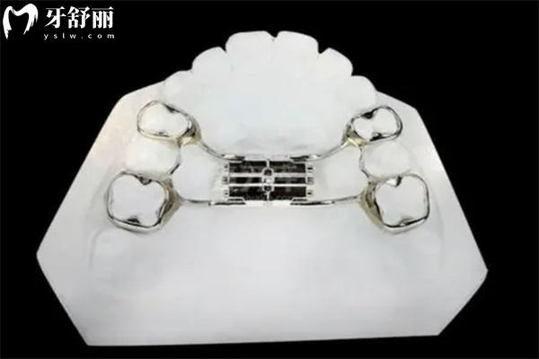 牙齒擴(kuò)弓是上下一起擴(kuò)的嘛