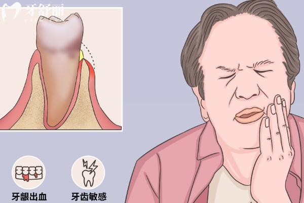 牙齦萎縮能治療嗎？可以治療，原因、方法點(diǎn)擊查看