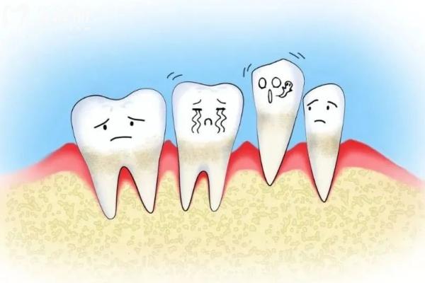 牙齦萎縮能治療嗎？可以治療，原因、方法點(diǎn)擊查看
