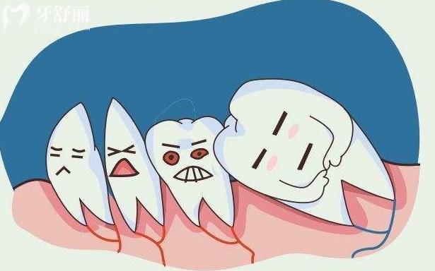 智齒爛個(gè)洞是拔還是補(bǔ)