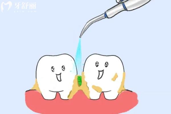 沖牙器是智商稅嗎？