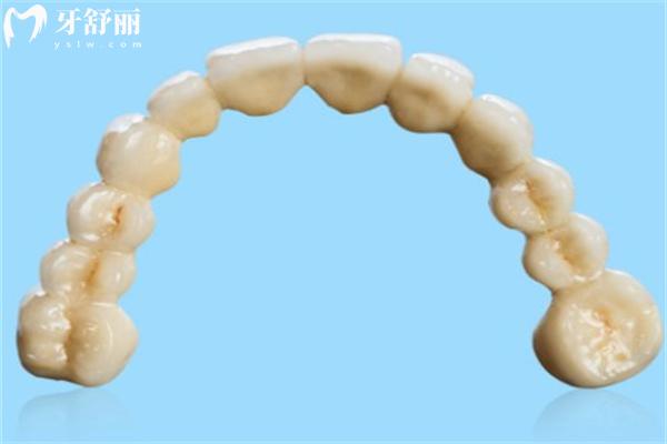 德國(guó)貝格鈷鉻烤瓷牙