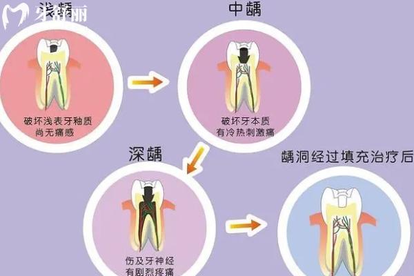 補(bǔ)過牙的牙齒痛怎么辦