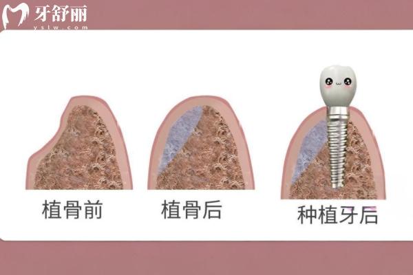 興隆臺諾亞口腔怎么樣？