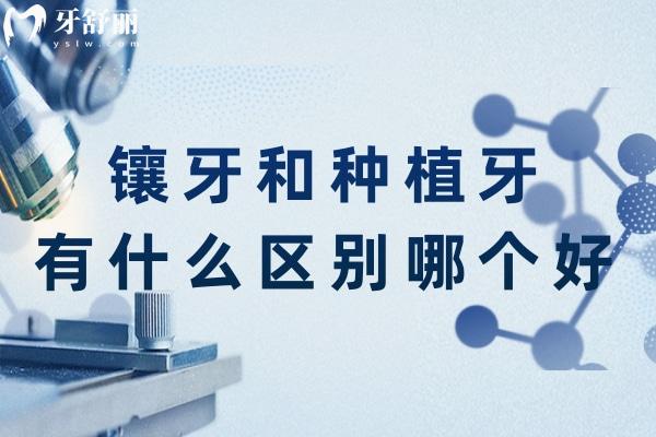 鑲牙和種植牙有什么區(qū)別哪個好