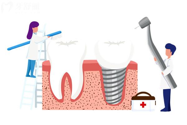 目前種植牙技術(shù)過關(guān)嗎