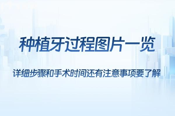 種植牙過程圖片一覽:詳細步驟和手術(shù)時間還有注意事項要了解