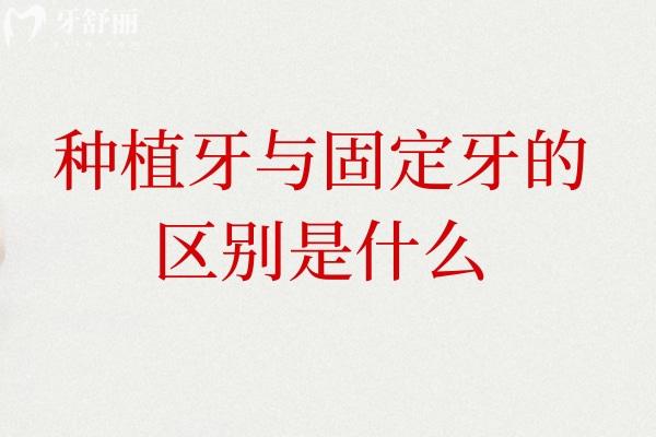 種植牙與固定牙的區(qū)別是什么