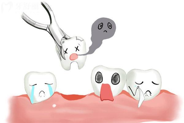 牙齒缺失為什么會導(dǎo)致牙槽骨萎縮