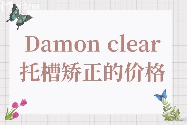 除了Damonclear托槽矯正的價格，還需了解這款矯正器的優(yōu)缺點