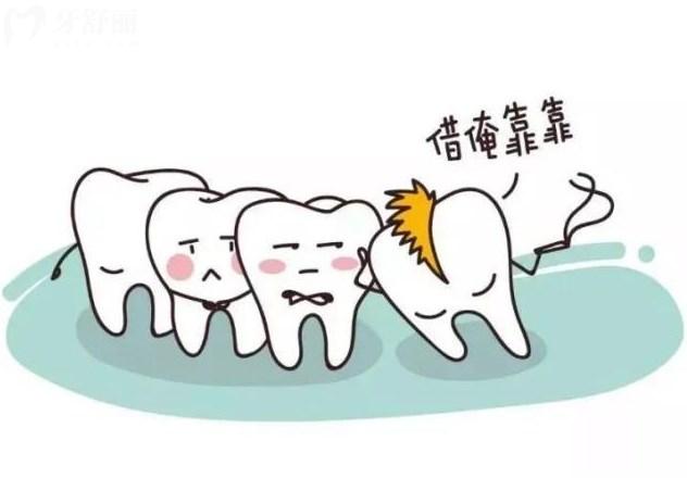 牙醫(yī)告知哪些智齒不需要拔除