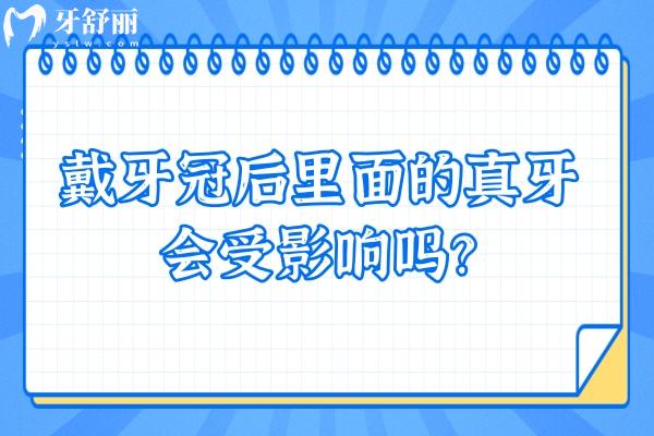 戴牙冠后里面的真牙會(huì)受影響嗎？長時(shí)間后是會(huì)有部分影響