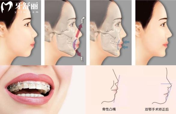 荊門牙齒矯正醫(yī)院排行