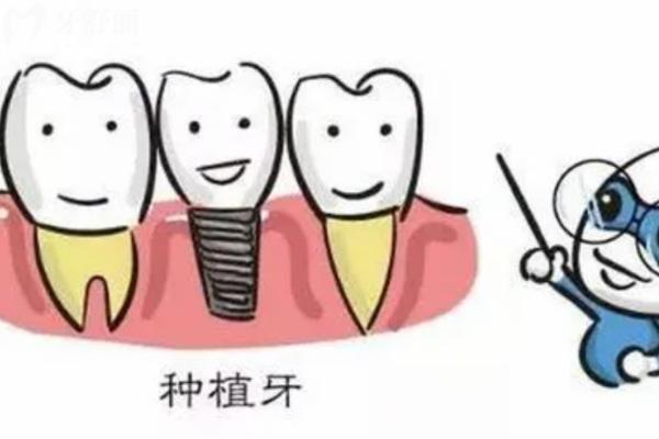 安徽蕪湖種植牙多少錢一顆2024價格表 涵蓋種牙/整牙/拔牙/洗牙/補牙價目表