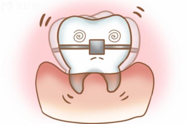 蕪湖牙齒矯正多少錢