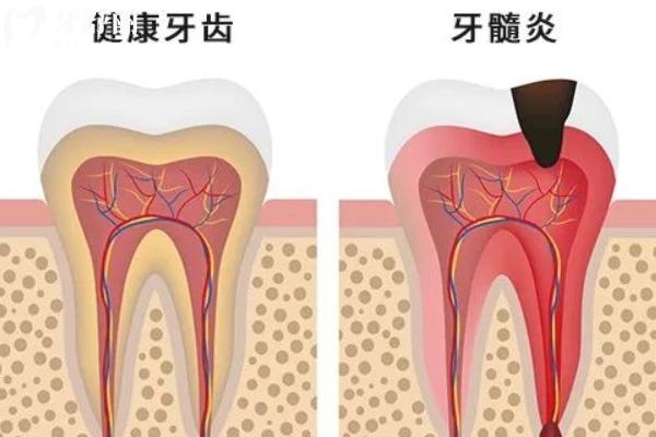 牙疼和壓力大有關(guān)系嗎？