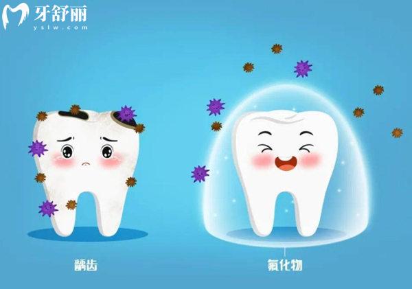 兒童涂氟材料哪種好
