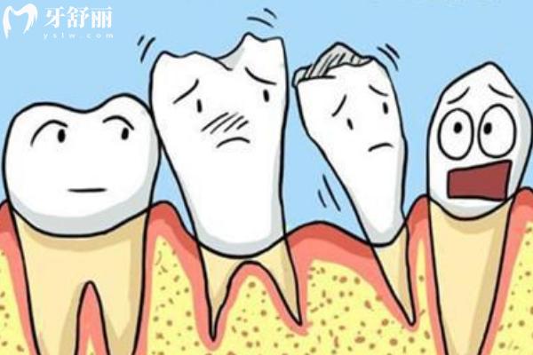 老人有牙周病還能鑲牙嗎？要看組織破壞程度，穩(wěn)定后就可以