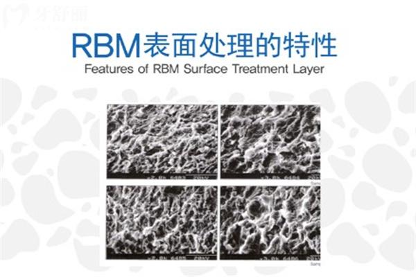 韓國禎諾種植體