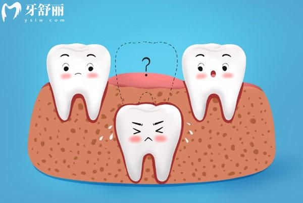 小孩大牙壞了以后會換新牙嗎