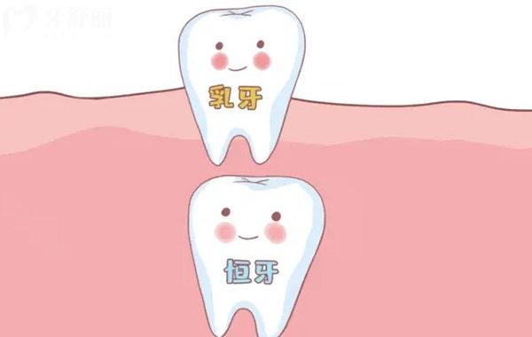 小孩乳牙壞了應(yīng)該怎么處理