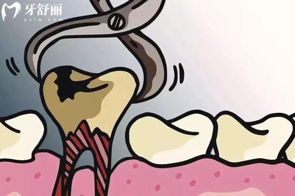 全新溫嶺朗德口腔醫(yī)院收費標(biāo)準(zhǔn):根管治療400+種植牙1580+矯正880+