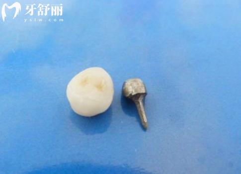 鋼樁的優(yōu)缺點(diǎn)及價(jià)格