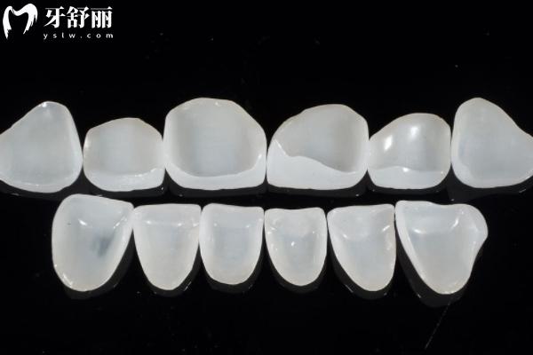 牙貼面做8顆還是16顆更好