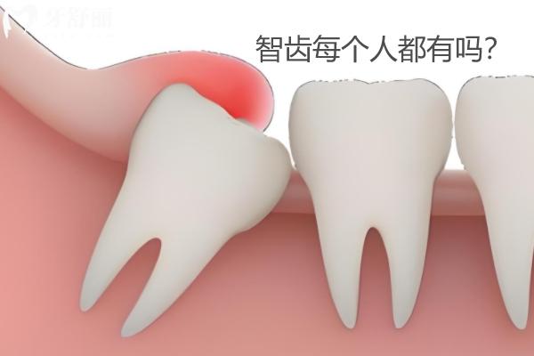 智齒每個人都會長嗎？