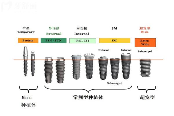 韓國(guó)dio迪耀種植牙