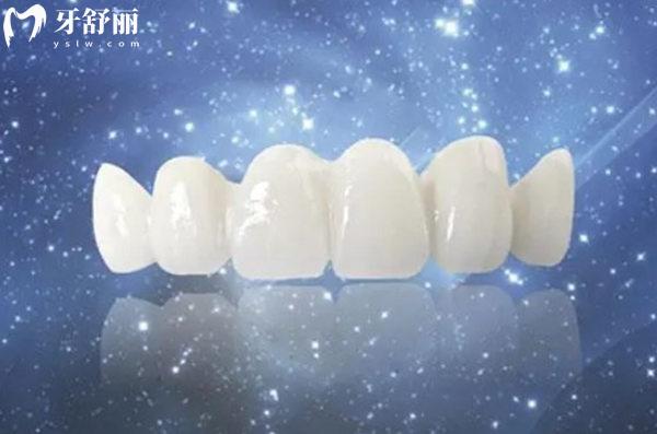 西寧鑲牙多少錢(qián)一顆