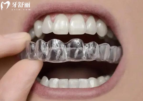 牙齒矯正保持器的作用