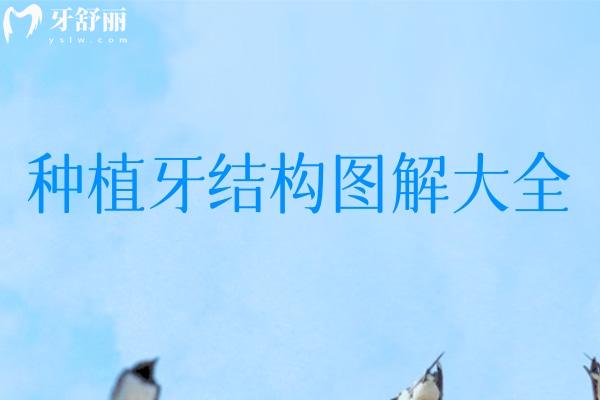種植牙結構圖解大全 