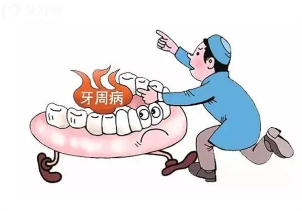 為什么牙周炎牙齒掉光后需要先治療牙周炎才能種植牙