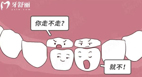 兒童雙層牙齒怎么處理