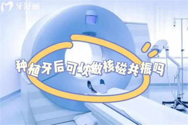 奧齒泰種植牙可以做核磁共振嗎?