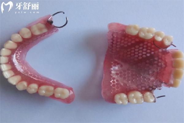 黃浦區(qū)口腔醫(yī)院鑲牙冠/假牙多少錢？
