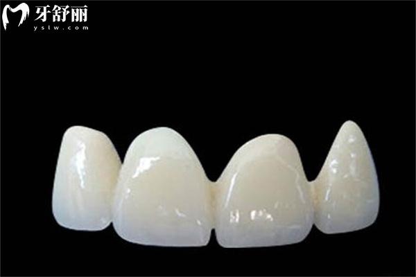 牙齒有縫隙吃東西塞牙怎么辦?