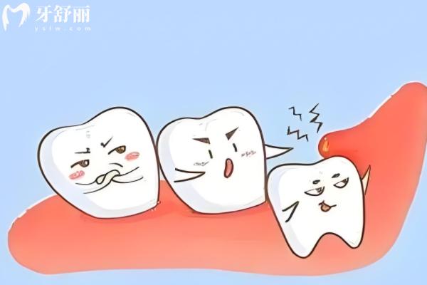 為什么牙疼的時(shí)候不能拔牙？