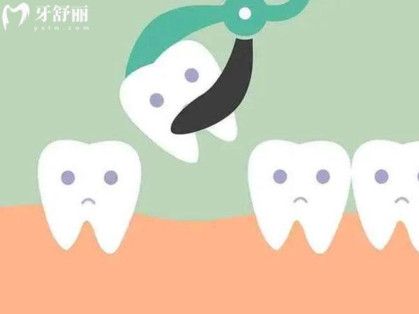 拔牙前的注意事項