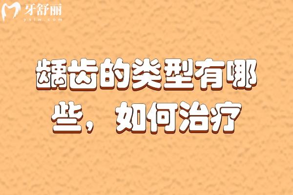 齲齒的類型有哪些？齲齒該如何治療？