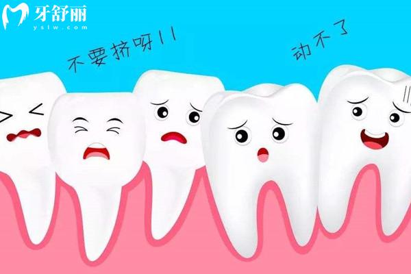 牙齒矯正26歲還來得及嗎