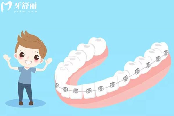 牙齒矯正26歲還來得及嗎