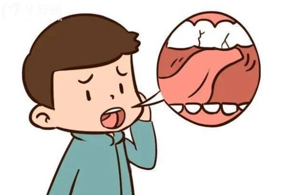 乳牙磕斷了一半怎么辦？直接拔掉還是修復？