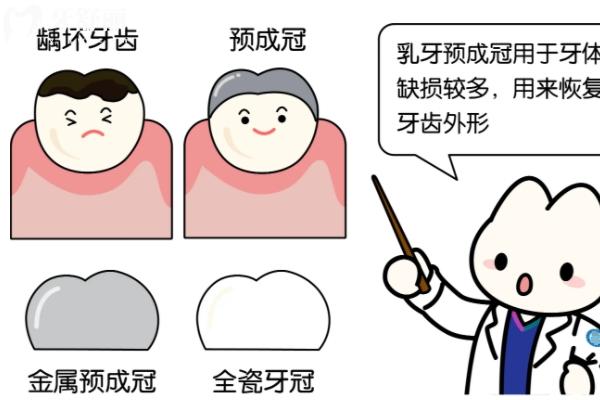乳牙磕斷了一半怎么辦？直接拔掉還是修復？